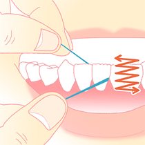 歯間ブラシ